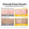 No.5 Vitamin-Niacinamide Concentrated Toner 70 Pads