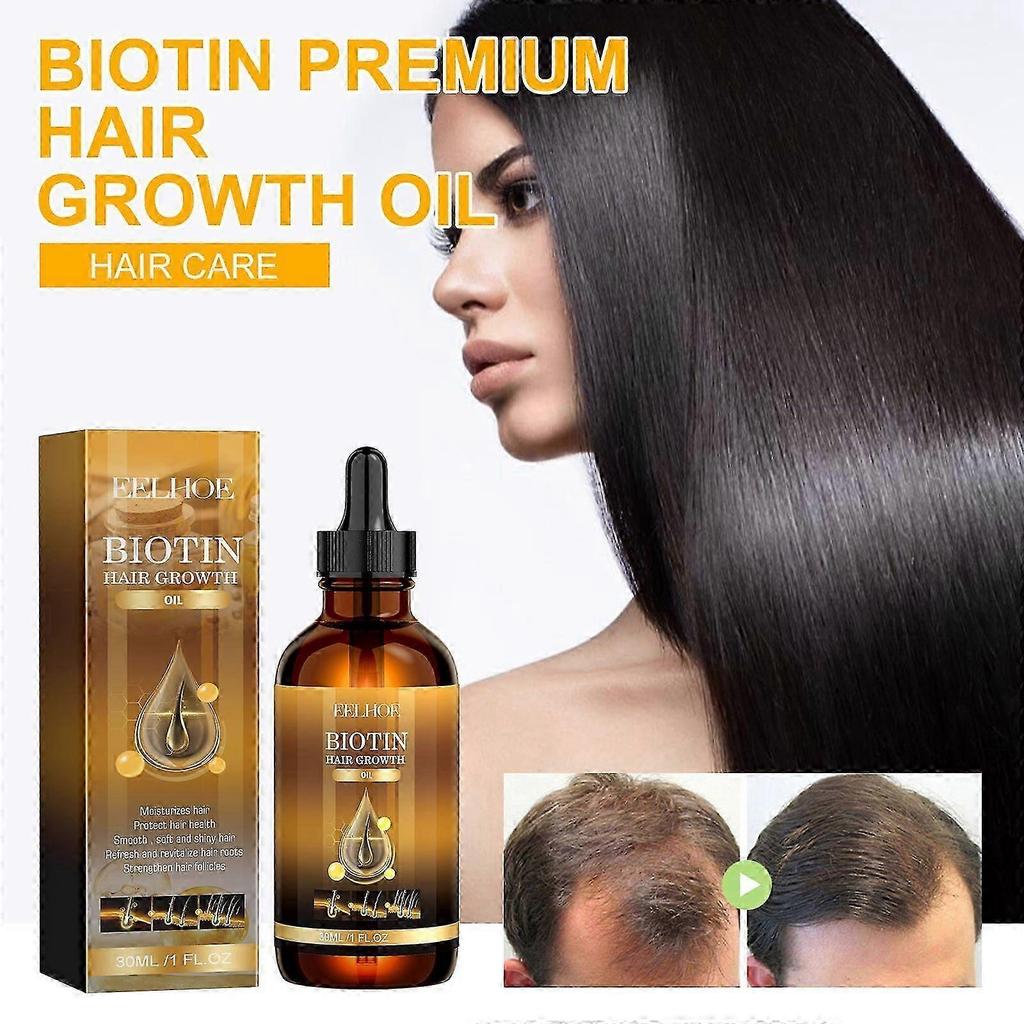 EELHOE Biotin Hair Growth Oil 30ml Anti Hair Loss Scalp Treatment Hair Strengthening Oil Serum