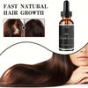 Ginger Hair Growth Essence Oils Products Anti Hair Loss Treatement Fast Growing Germinal Serum Prevent Scalp Damaged Men Women