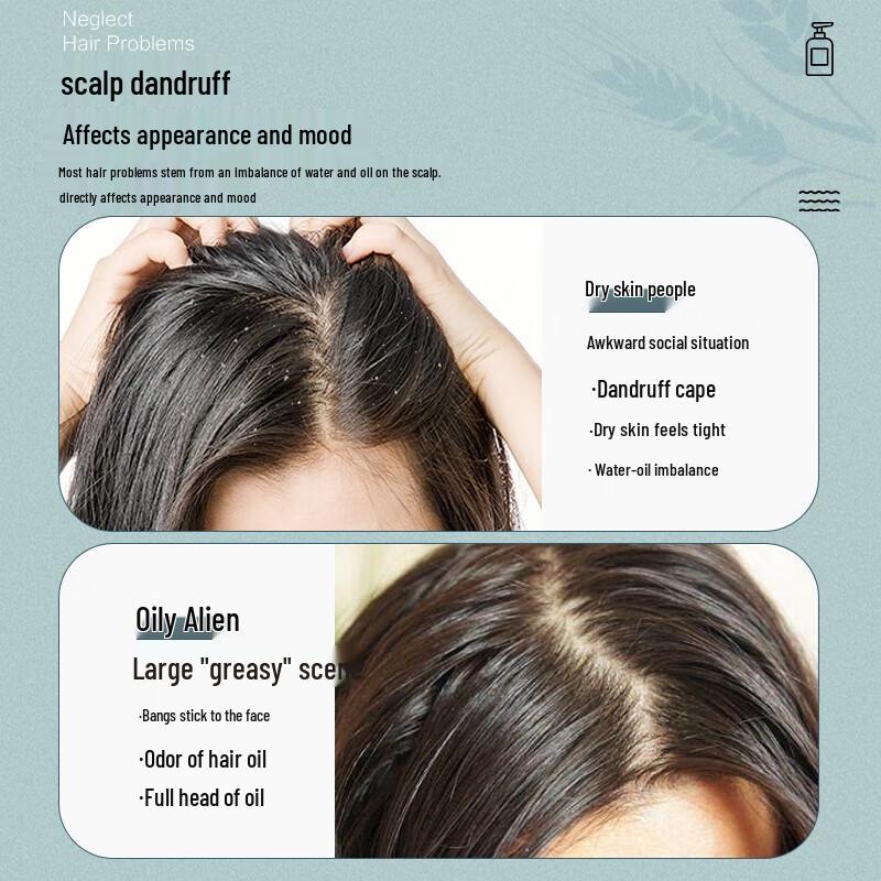 Gu Li Xiang Refreshing Anti-Dandruff Shampoo