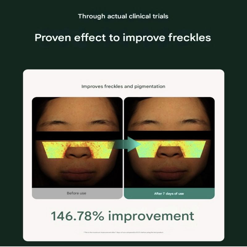 MOMMY CARE Perilla Seed Brightening Cream Extra Large 80g