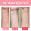 Calamine Detoxifying Cream 20g, Anti-itching Skin Care Cream