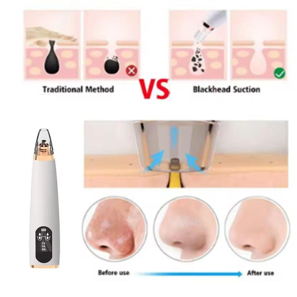 Facial Deep Face Beauty Equipment USB Rechargeable Blackhead Suction Vacuum  Beauty Equipment