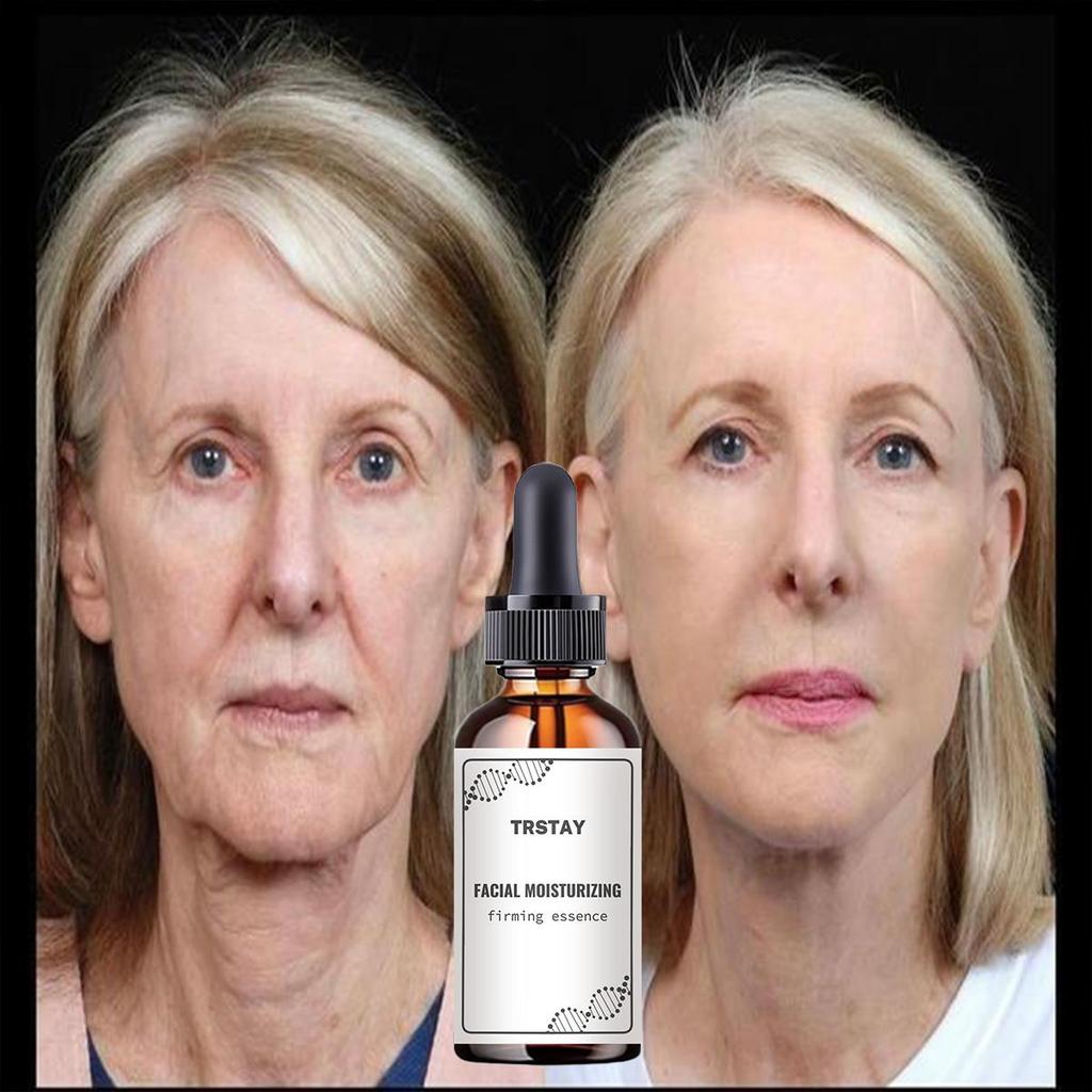 5G/15G/30G/50G/TRSTAY Moisturizing Cream, Vitamin C Brightening Face Cream, Brightening Skin And Lightening Spots