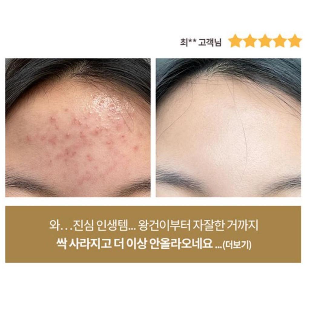 [Lory&Chel] Glorious Essence Ampoule Serum 80g