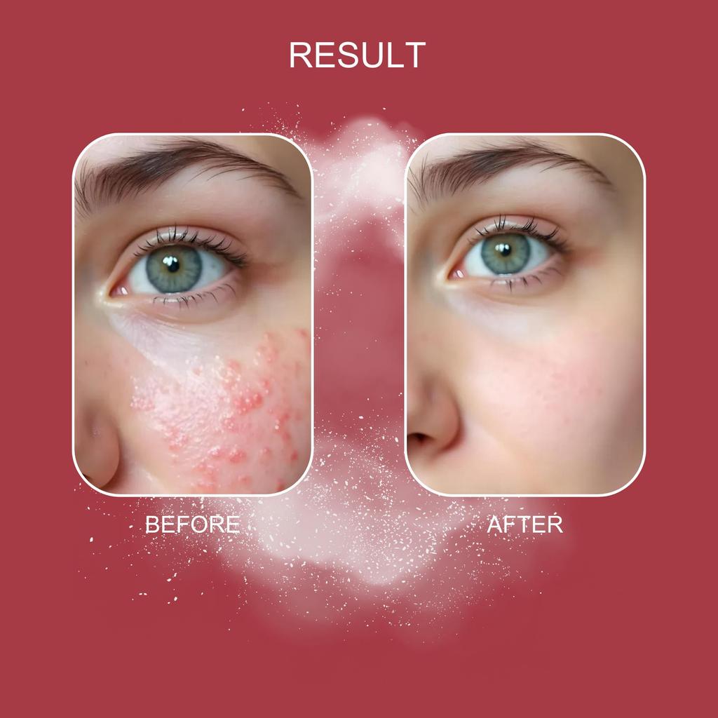 Health Peel Jessner's Peel, 30ml. / Jessner Peeling, 30ml.