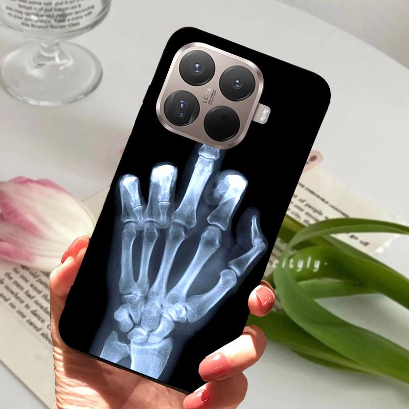 Für Xiaomi 15T Pro 15TPro Hülle Mode Löwen Tiere Fundas Weiche Silikon TPU Handyhüllen Für Xiaomi 15 T Pro Stoßfeste Hülle