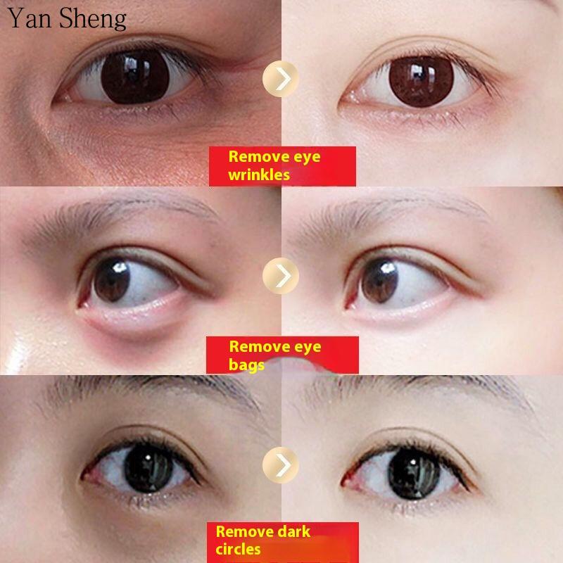 Caviar Eye Cream Anti-wrinkle Tightening and Rehydrating Anti-aging Fading Dark Circles Stay Up Late To Go Pouch