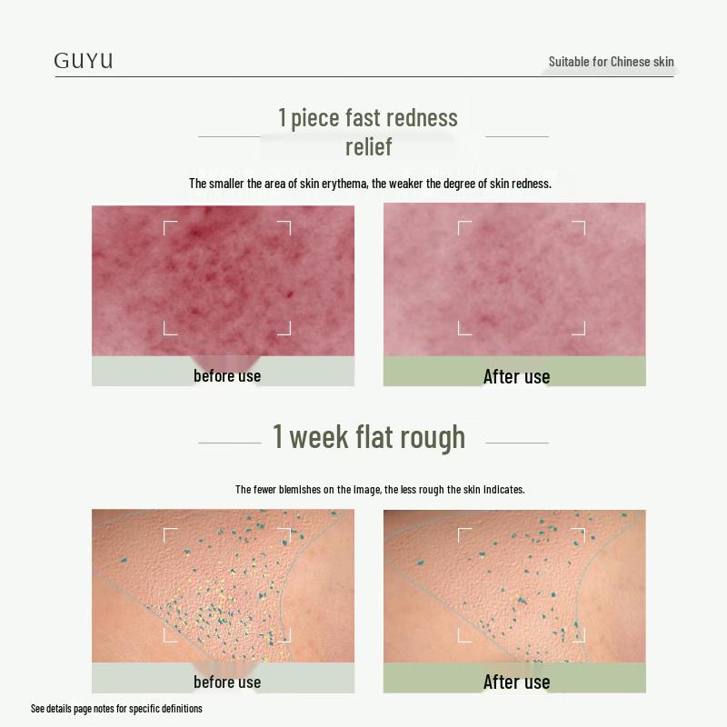 Zestaw nawilżająco-regenerujących masek do twarzy Guyu
