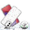 For Motorola Moto G84 5G Case Clear Acrylic TPU Hybrid Phone Cover with Laser-printed Film