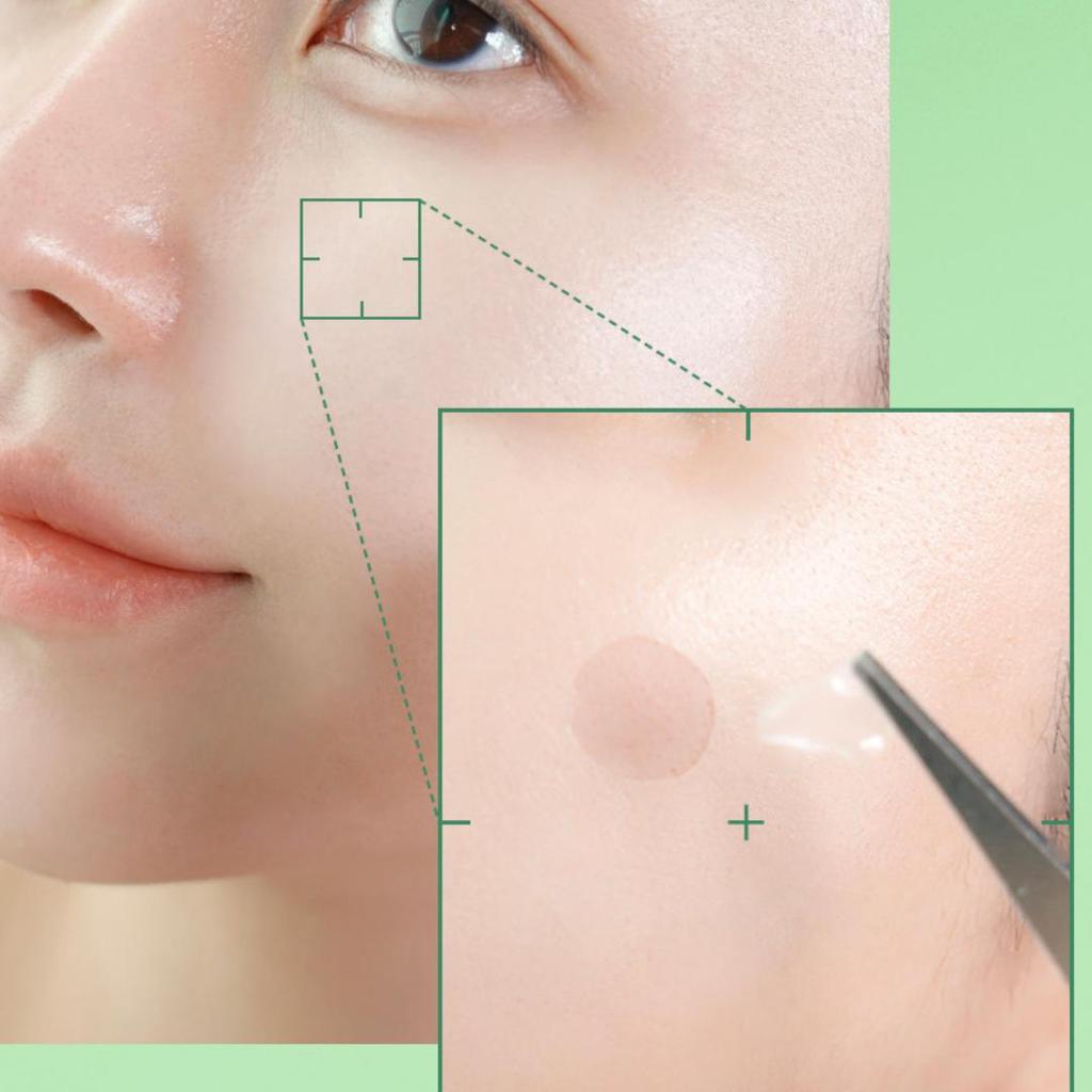 [FRANZ] Cerotti Spot Acne Nudi 72pz 3 tipi - Precoce / Attivo / Scuro