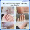 Clinical Hand Cream for Intensive Cracked Skin Repair