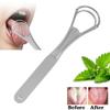 Oral Care Stainless Steel Tongue Scraper Medical Mouth Brush Tongue Brush Tongue Scraper Cleaner