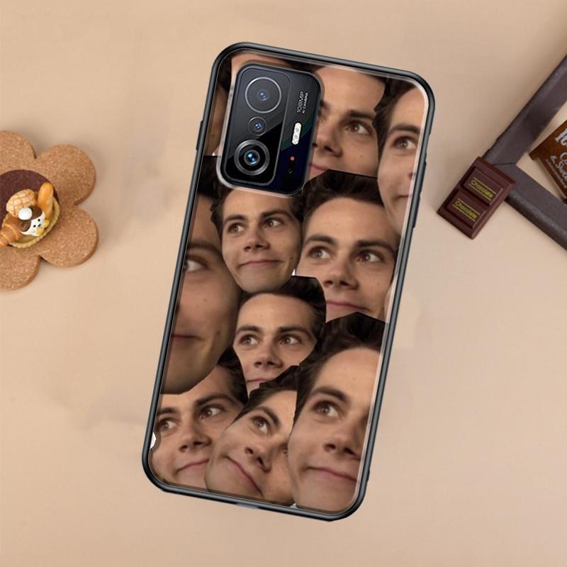 Teen Wolf Dylan Obrien Case For Xiaomi POCO X7 X6 Pro X3 X5 M6 F3 F5 F6 Pro 11T 12T 13T 14T Pro 13 14 Ultra Cover