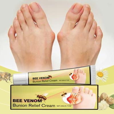 Hallux Valgus-pasta, Naturlig hallux valgus-lindringspasta med arnika | Hallux valgus-lotion & Hallux valgus-vård för hallux valgus-smärta | Hallux valgus-massage