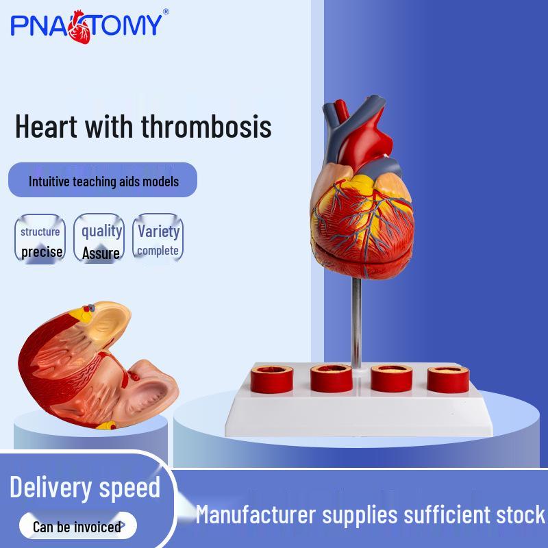 Anatomical Large Heart Model with Detachable Thrombus for Teaching 20x15x22 cm