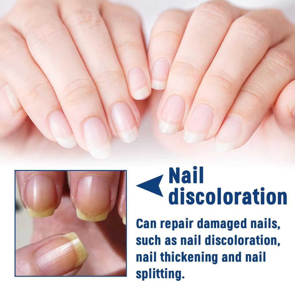 Ximonth Nährende Formel für gesunde, starke, weiche Nägel und Nagelhautpflege
