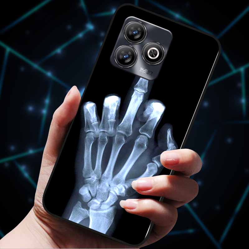 Für TCL 20 Pro 5G Hüllen Modische Weiche TPU Silikon Rückabdeckungen für TCL 20Pro 5G Rückseite Cartoon Katze Hülle Bumper TCL20Pro T810H