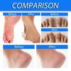 Ximonth Heel Repair Cream For Cracked Dry Skin Nourishing Moisturizing Foot Care 40g