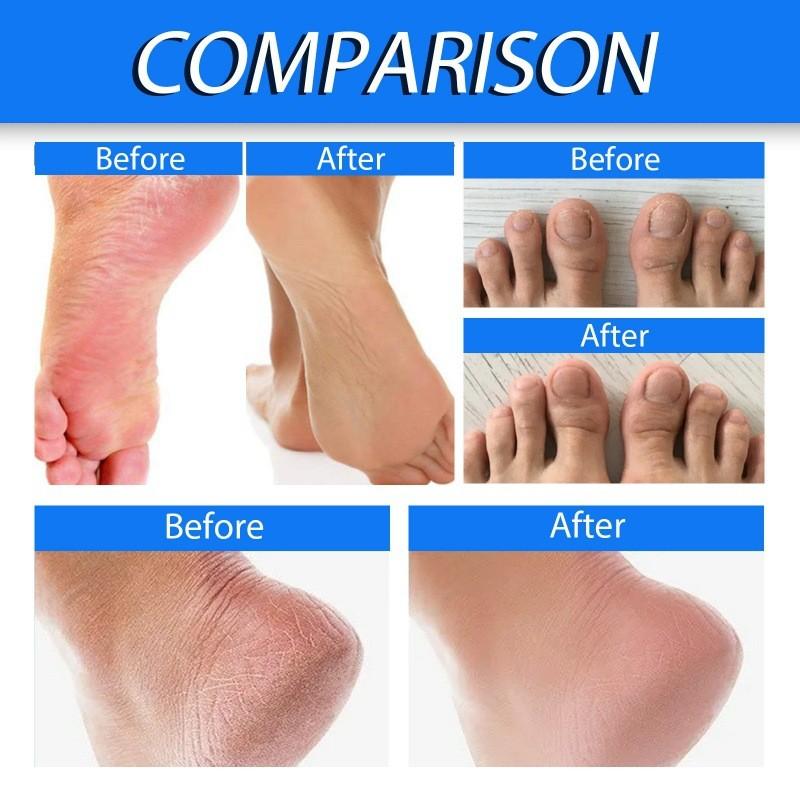 Ximonth Heel Repair Cream For Cracked Dry Skin Nourishing Moisturizing Foot Care 40g