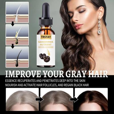 Aceite para el crecimiento del cabello fermentado con arroz, esencia, aceites para el cabello, suero para el crecimiento, ingredientes nutritivos ricos, promueve un crecimiento más grueso y fuerte