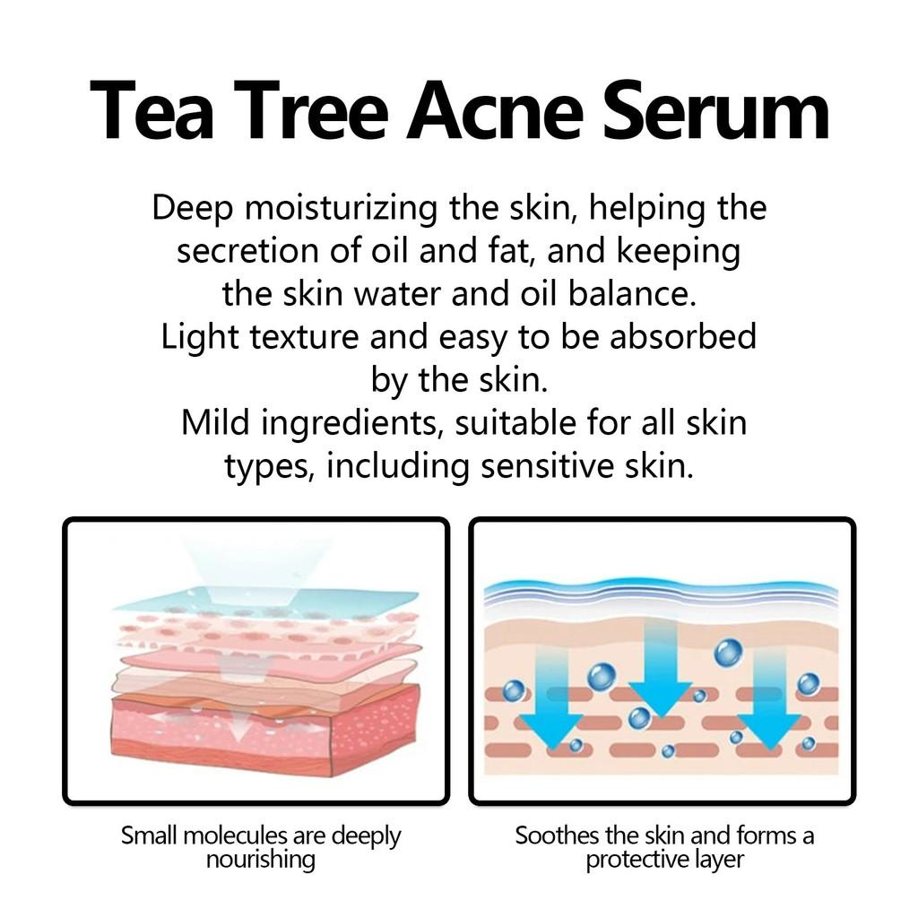 Eelhoe Green Tea Acne Serum Nourishing Antioxidant Formula For Brightening And Moisturizing