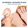 50 Pcs Ingrown Toenails Patch Sticker Toenail Patch Corrector Pedicure Tools Ingrown Toenail