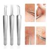 Blackhead Removal Clip Set for Skincare - 3 Piece Stainless Steel Tools