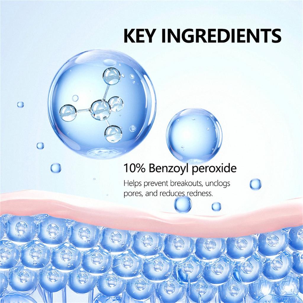 Benzoyl Peroxide Foaming Facial Cleanser 85g -acne Oil Control Gentle Cleansing Facial Cleanser