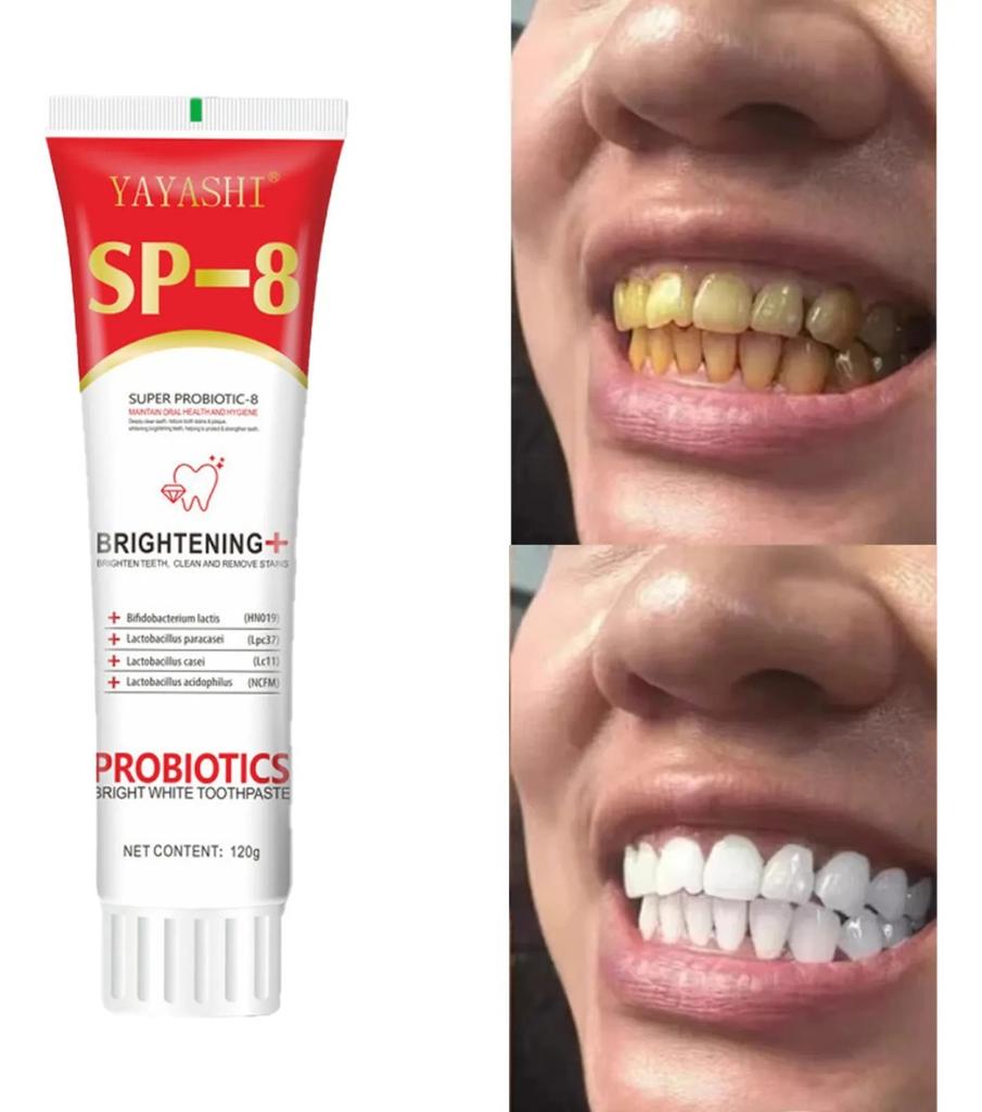 SP-8 Probiotic Brightening Toothpaste 120g, Super Probiotic-8 Oral Toothpaste, Clean Teeth & Remove Surface Stains, Daily Oral Hygiene Care