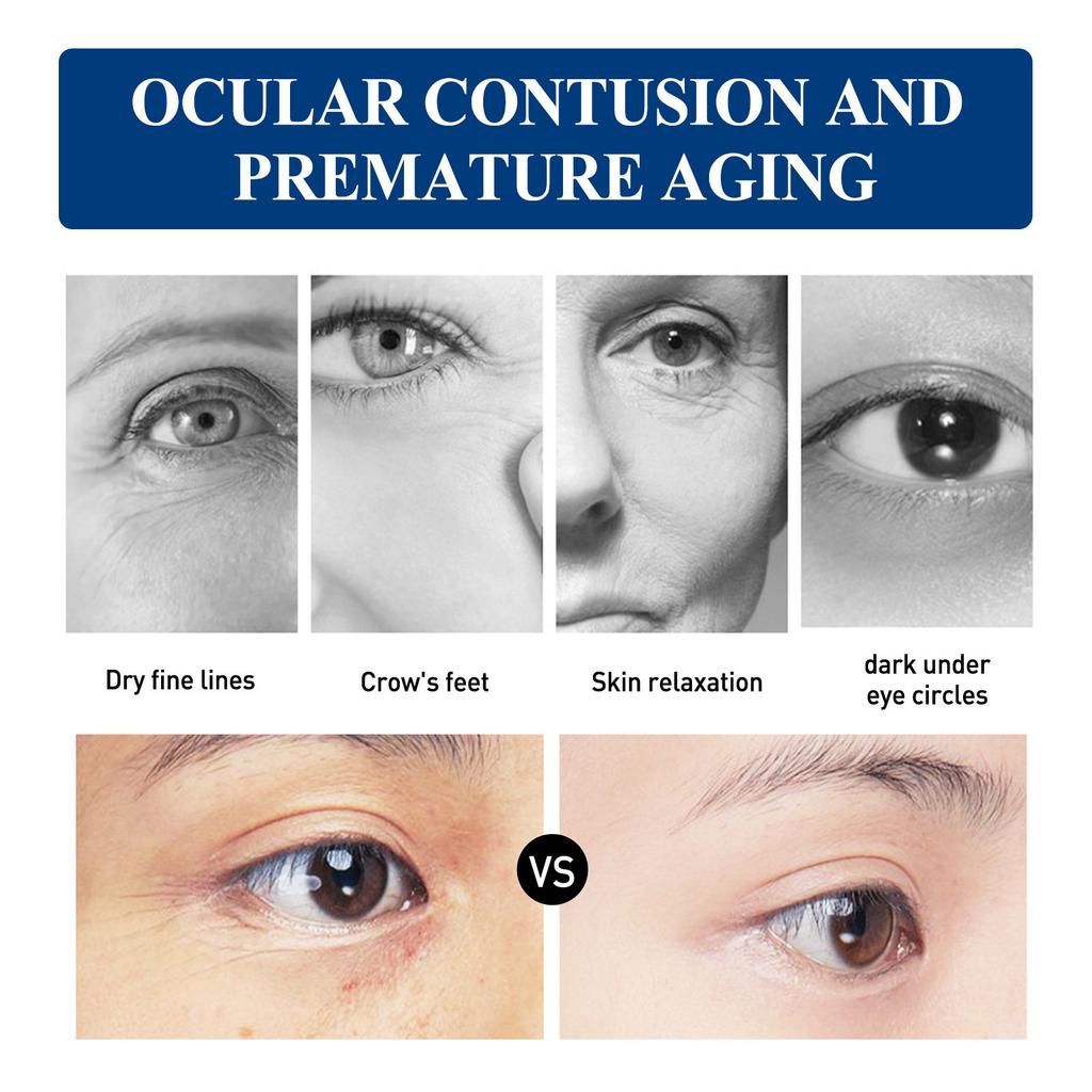 EELHOE Hyaluronic Acid Whitening Eye Cream Anti Dark Circles Eye Bags Wrinkle Removal Skin Serum Brighten Moisturizer Eyes Beauty Health