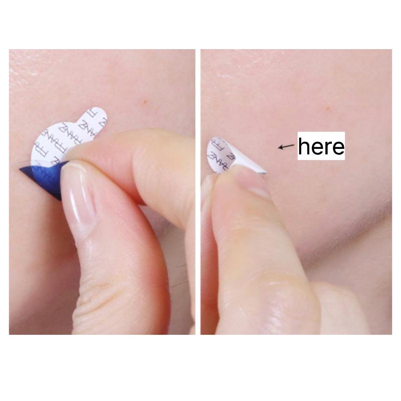 Franz Naked Spot Patch 72 Patches | Invisible Hydrocolloid Acne Patch
