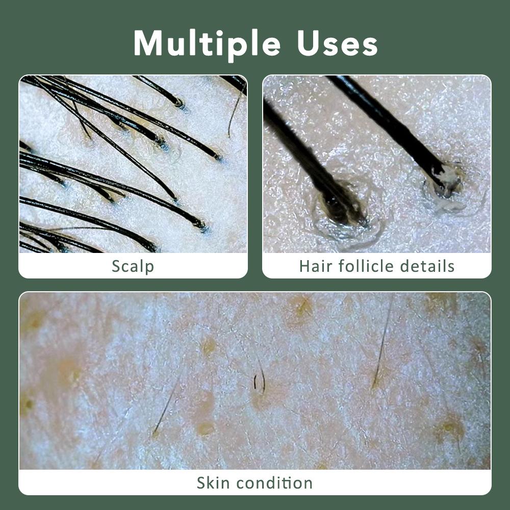 Visual Dermatoscope Scalp Facial Skin Analyzer Machine 1000X Skin Magnifier Scalp Diagnostic Machine Wifi Microscope Skin Test