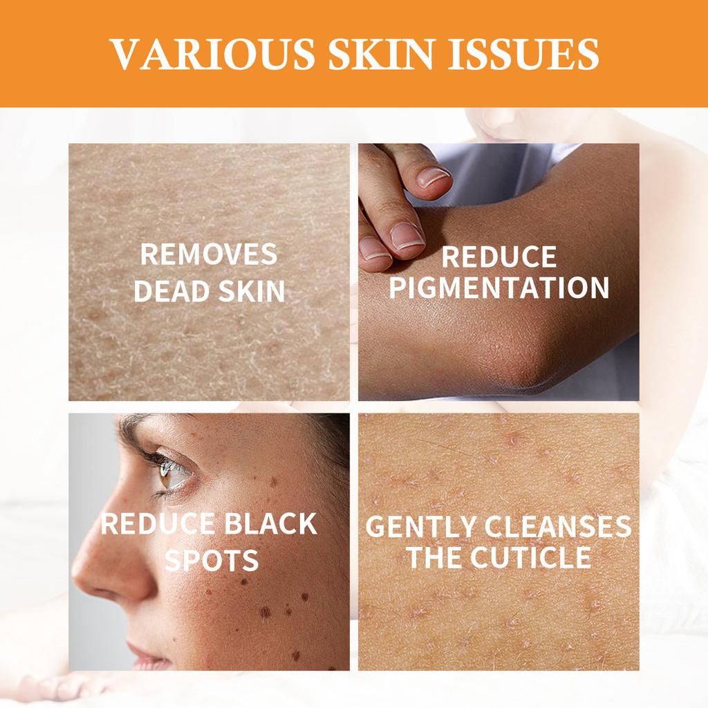 Eelhoe Turmeric Whitening Skin Soap For Elbows Knees And Intimate Areas Nourishing Hydrating And Brightening Effect