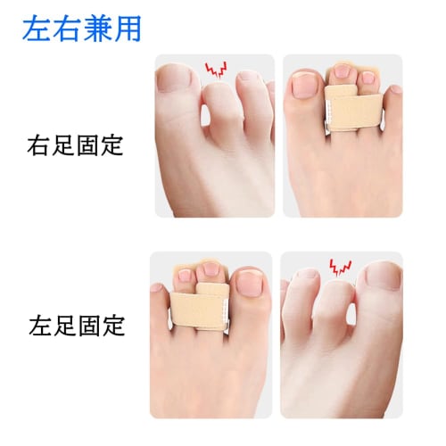 Toe Joint Stabilizer, Flexibility Support, Toe Joint Support, Finger Fracture, Aluminum Plate, Toe Protection, Injury Rehabilitation, Toe Stabilizer,
