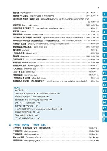 Easy-to-understand Brain MRI, Revised 4th Edition (Image Diagnosis Special Edition KEY BOOK Series)