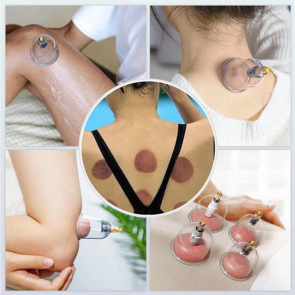 Cupping Device 12Pcs Set Vacuum Cupping For Therapy Body Massager with Magnetic Therapy Head