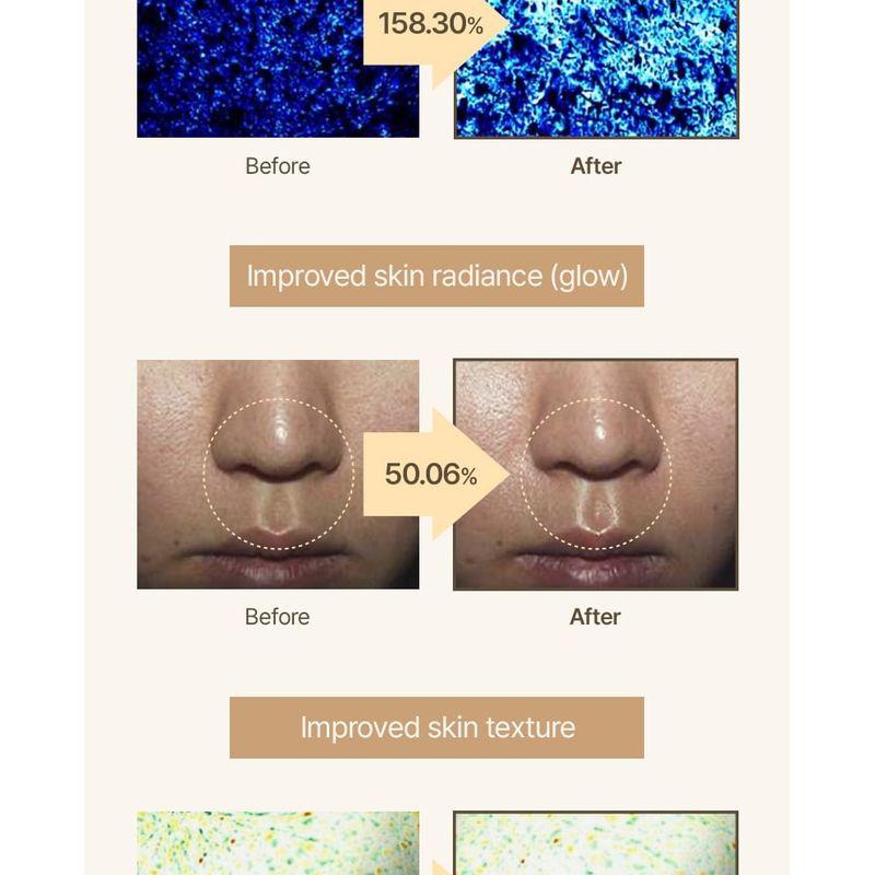 SOME BY MI - 30 Days Miracle Clear Spot Patch