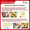 Authentic Thai Imported Ventilation Nasal Patch To Relieve Nasal Congestion Runny Nose Anti Snoring Sneezing Anti-snoring Patch Body Care Patch