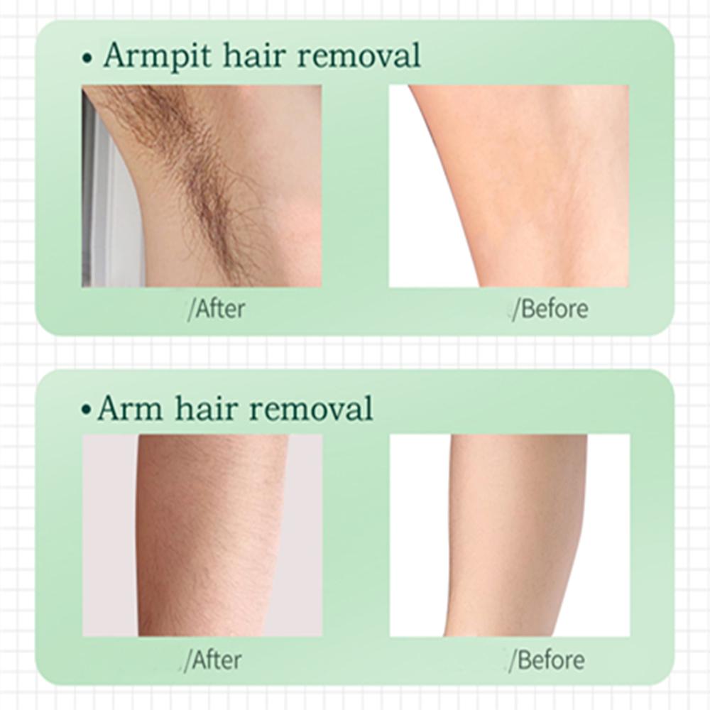 IPL Hair Removal Epilator Permanent Face Leg Arm Body Hair Remover Machine NEW