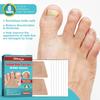 16pcs/box Foot Nail Repair Patch Grey Fungal Nail Thicken Soft Paronychia Infection Hand Nail Correction Sticker Ingrown Toenail
