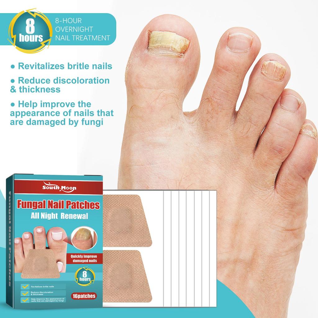 16pcs/box Foot Nail Repair Patch Grey Fungal Nail Thicken Soft Paronychia Infection Hand Nail Correction Sticker Ingrown Toenail