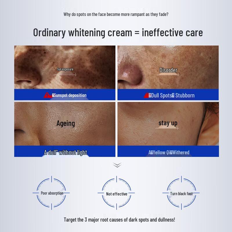 HURMEVKOR 377 Aufhellende & Straffende Fleckenentfernende Creme