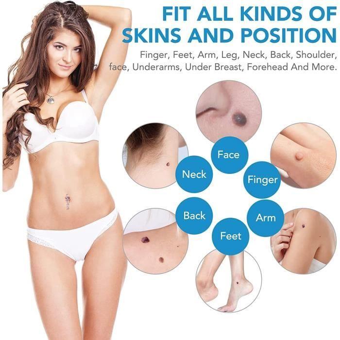 2 In 1 Skin Tags Treatment, Acrochordon Removal Kit Pen Delimitation For the Face, Neck, Finger and Body