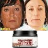 Become Beauty Extract de ginseng Crema de albire Elimina pistruii Crema de albire pentru pete de pistrui