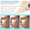 Zuvexa Silicone Scar Sheets Tape – Reusable Medical Grade Scar Removal Strips for C-Section, Surgery, Acne, Keloid, Tummy Tuck – Painless & Effec