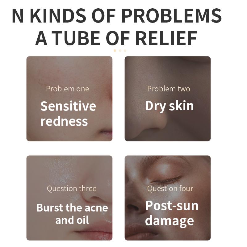 TJE Aloe Vera Gel 150g Feuchtigkeitsspendend, für zarte, zu Akne neigende und antiempfindliche Haut