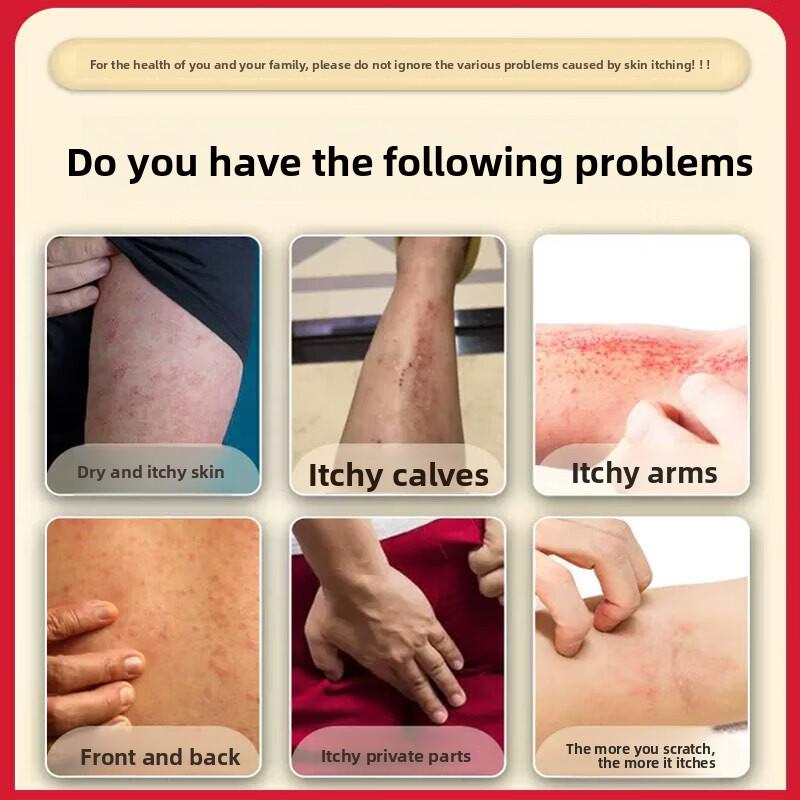 Skin Itching Anti-Itching Soothing Cream for Hips, Back, Thighs, Whole Body Itching