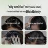BaWang Anti-Hair Loss Hair Growth Set
