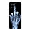 Coque For Vivo iQOO 15 5G Case 6.85" Animal Lion Tiger Cats Soft Silicone TPU Back Cover For Vivo iQOO 15 2025 Phone Cases Shell